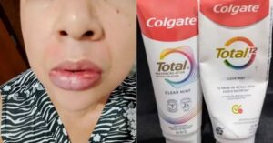 Lee más sobre el artículo Pro Consumidor y Digemaps acuerdan mantener vigilancia de pasta dental Colgate Total Prevención Activa Clean Mint